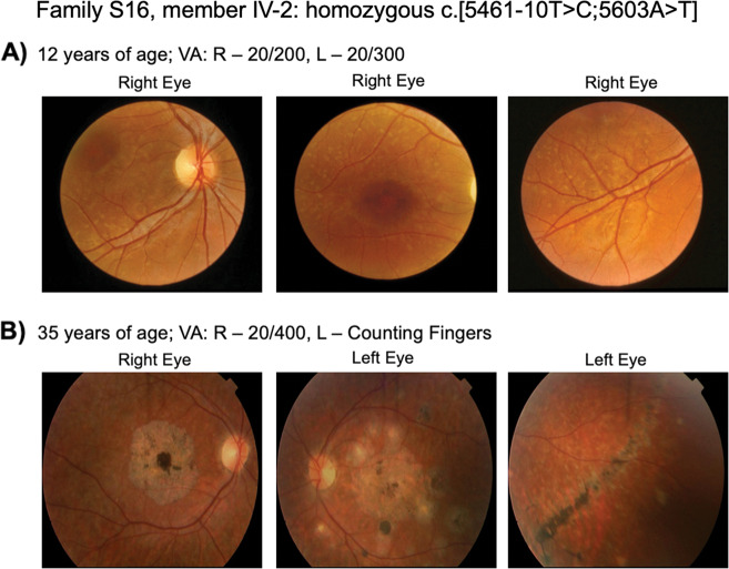 Fig. 4