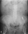 Fig. 2