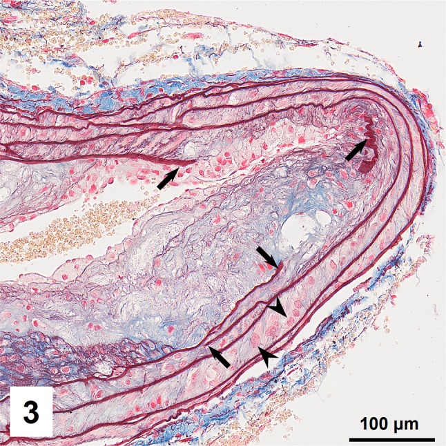 Fig. 3