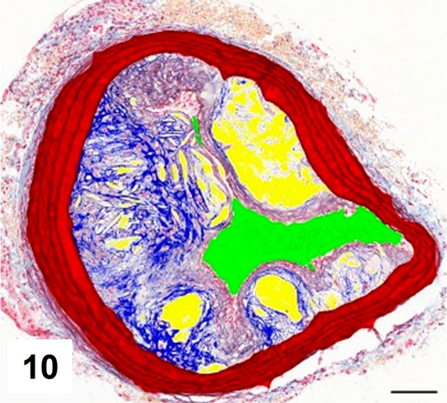 Fig. 10