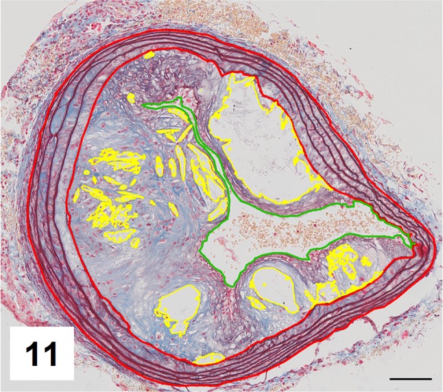 Fig. 11