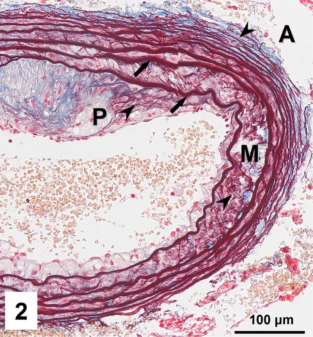 Fig. 2