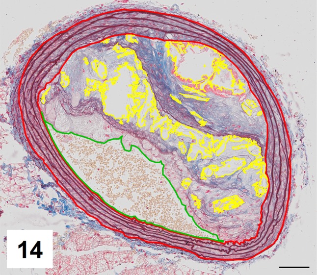 Fig. 14