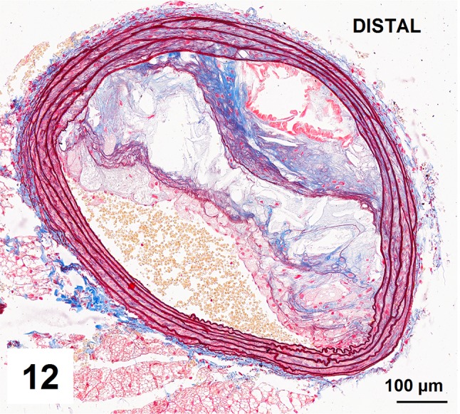 Fig. 12