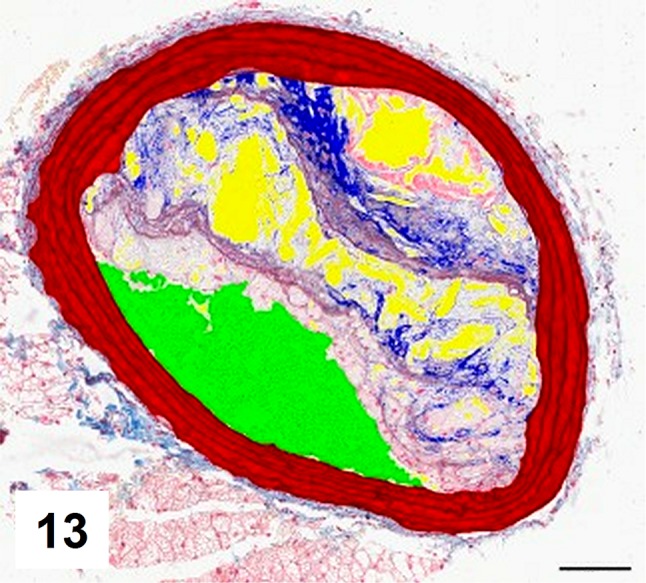 Fig. 13