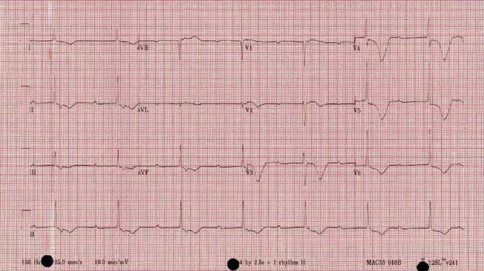 Figure 2