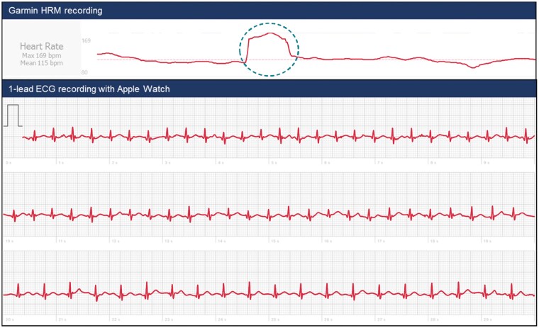 Figure 12