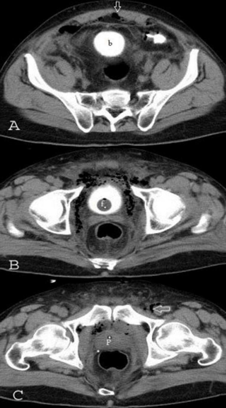Fig. 2
