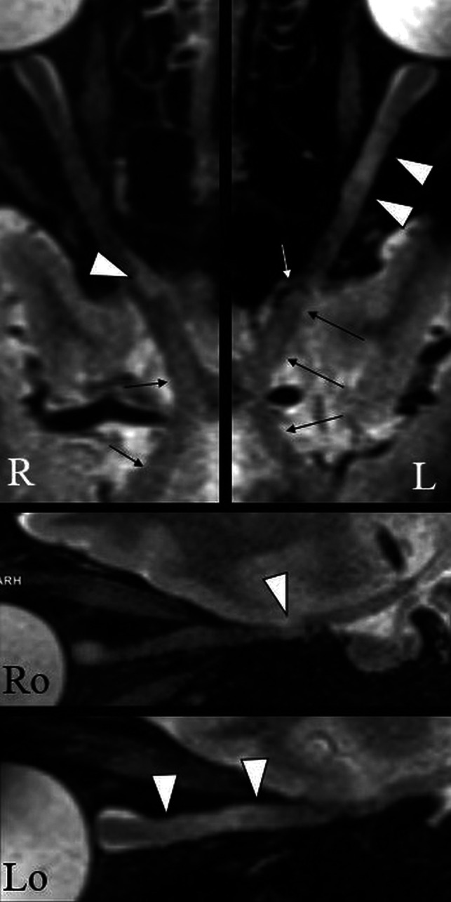 FIG 3.