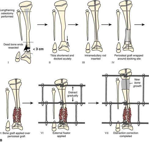 Fig. 3A–B