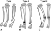 Fig. 1A–C