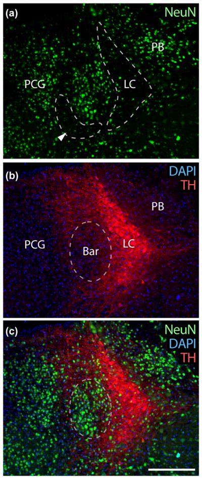 FIGURE 3