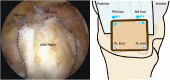 Fig 14