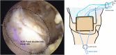 Fig 11