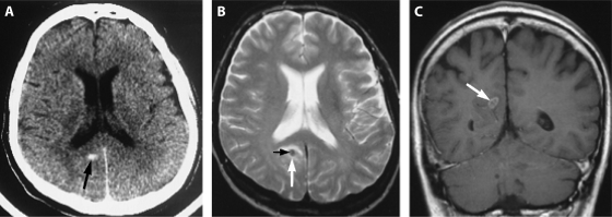 FIG. 5.