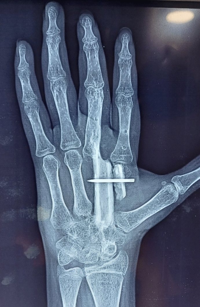 Fig. 9