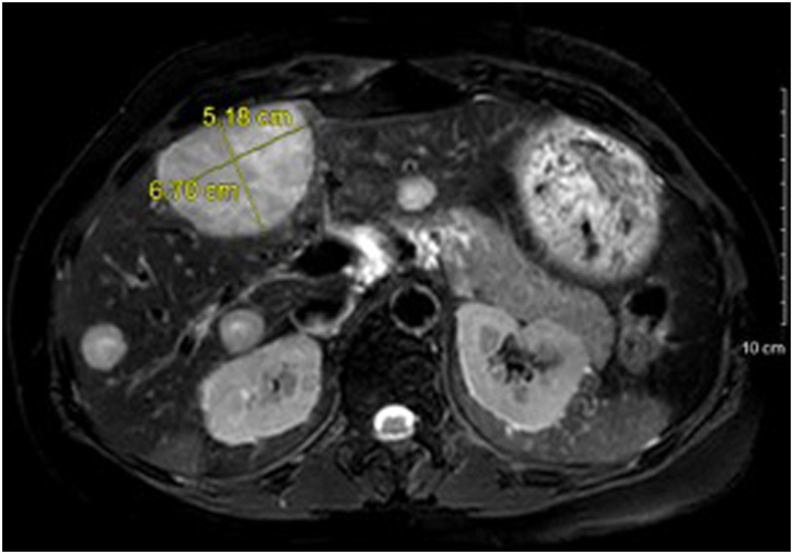 Fig. 2