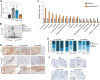 Figure 5. Pkm2 deletion suppresses increased glucose uptake, affects metabolite levels, and prolongs DNA replication stress and cellular senescence in Pten-null prostate tissue. A, Maximum relative [18F]fluoro-2-deoxyglucose signal (SUV Max) in prostate tissue as assessed by PET of 6-month-old wild-type (WT), Ptenpc–/–, Pkm1;Ptenpc–/–, and Pkm2;Ptenpc–/– mice. Prostate signal normalized to the intensity of the emission spectra in the heart of the same mouse is shown (WT, n = 3; Ptenpc–/–, n = 3; Pkm1;Ptenpc–/–, n = 3; Pkm2;Ptenpc–/–, n = 4). The indicated differences in FDG uptake are significant (*, P < 0.05 by Student t test). B, Principle component analysis of 111 polar metabolites measured by LC/MS in prostate tissue harvested from 6-month-old WT, Ptenpc–/–, Pkm1;Ptenpc–/–, and Pkm2;Ptenpc–/– mice (WT, n = 8; Ptenpc–/–, n = 10; Pkm1;Ptenpc–/–, n = 6; Pkm2;Ptenpc–/–, n = 6). C, Relative levels of all metabolites measured by LC/MS that were significantly different (P < 0.05 by Student t test) in a comparison of prostate tissue harvested from 6-month-old Pten–/– or Pkm2;Pten–/– mice (Ptenpc–/–, n = 10; Pkm2;Ptenpc–/–, n = 6). D, Representative IHC staining for phospho-Chk1 in prostate tissue harvested from Ptenpc–/–, Pkm1;Ptenpc–/–, and Pkm2;Ptenpc–/– mice of the indicated age. Scale bar = 200 μm. E, Quantitation of phospho-Chk1 staining in prostate tissue harvested from Ptenpc–/–, Pkm1;Ptenpc–/–, and Pkm2;Ptenpc–/– mice of the indicated age as determined by IHC. Tissue from 3 to 6 mice per age group was quantified. F, Representative SA-β-gal staining of anterior prostate tissue harvested from 6-month-old WT, Ptenpc–/–, Pkm1;Ptenpc–/–, and Pkm2;Ptenpc–/– mice. The area indicated by the dashed box is shown larger in the lower left inset for the right two panels. Scale bar = 500 μm.