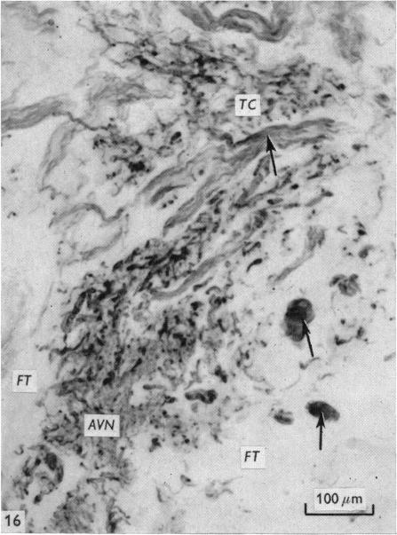 Fig. 16