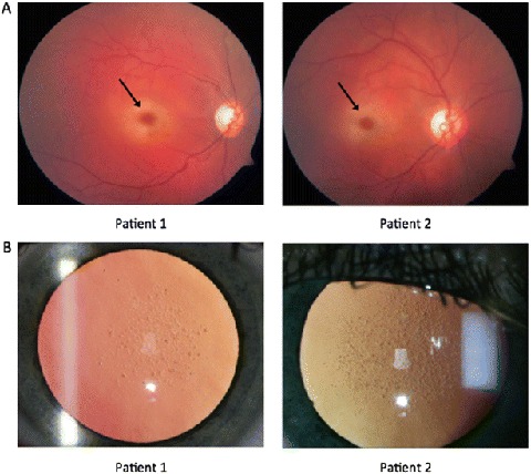 Fig. 1