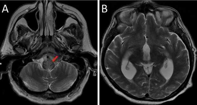 Figure 2: