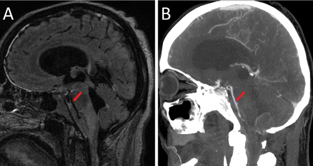 Figure 3: