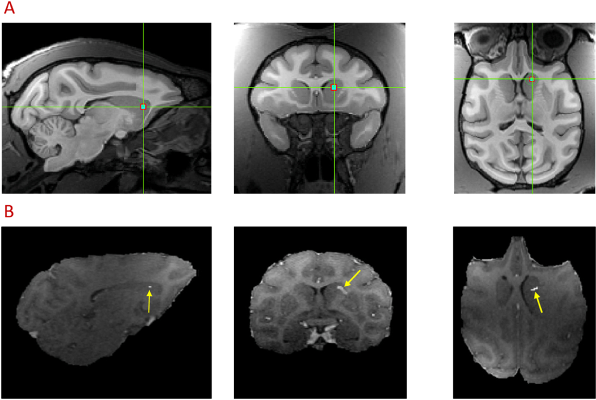 Fig. 2.