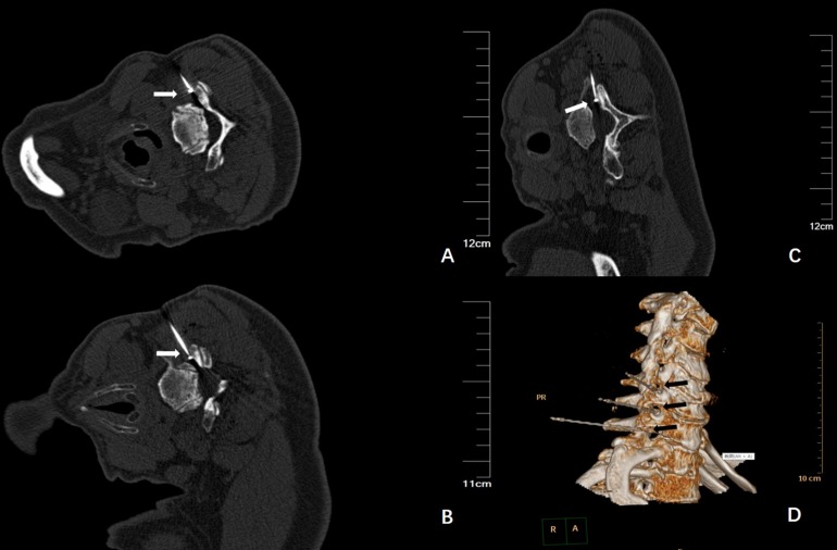 FIGURE 2