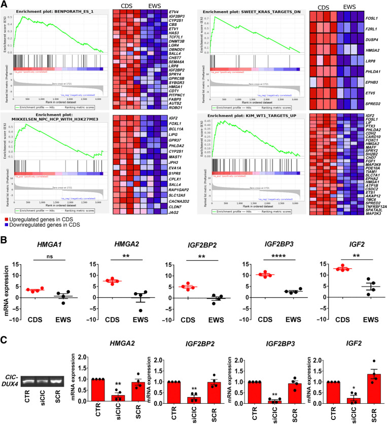 Figure 1. GSEAs and qRT-PCR validation reveal a unique transcriptional profile of CDS characterized by enriched expression of a HGMAs/IGF2BPs/IGF2 axis. A, GSEA reveals a significant enrichment of genes upregulated in patients with CDS versus Ewing sarcoma. CDS displayed a signature enriched for genes involved in embryonic stem cell development (Benporath_ES_1), KRAS signaling (Sweet_KRAS_TARGETS_DN), WT1 target genes (Kim_WT1_TARGETS_UP), and chromatin modification (Mikkelsen_NPC_HCP_WITH_H3K27ME3). The enrichment score curve was obtained using GSEA software. In the enrichment plot, the x-axis shows the rank order of genes from the most upregulated to the most downregulated between CDS and Ewing sarcoma samples. The vertical black line indicates the position of the enriched genes (Hit) comprising the gene set. The graph on the bottom shows the ranked list metric (signal-to-noise ratio) for each gene as a function of the rank in the ordered dataset. The heatmaps show the genes that contribute most to the enriched pathway or biological process resulting from the leading edge analysis. B, Validation of the RNA-seq results was performed by qRT-PCR and the results are shown in scatter plots. Each dot represents a tumor sample. Differential expression of genes between CDS and Ewing sarcoma was established by Student t test and correction for multiple comparisons using the Holm-Sidak method: **, P < 0.01; ****, P < 0.0001; ns, nonsignificant. The mean ± SE of relative mRNA expression (2–ΔΔCt) is reported as log2. GAPDH was used as a reference gene. C, Left, CIC-DUX4 silencing in PDX-CDS#4 cells by RT-PCR. Agarose gel electrophoresis image of a 233-base fusion transcript is shown. Right, relative mRNA expression (2−ΔΔCt) of HMGA2, IGF2BP2, IGF2BP3, and IGF2 after cell exposure to siCIC or scrambled (SCR) control siRNAs (40 nmol, 72 hours) by qRT-PCR. The mean ± SE of relative mRNA expression (2−ΔΔCt) is reported as log2. GAPDH was used as a reference gene. *, P < 0.05; **, P < 0.01; one-way ANOVA with respect to the control.