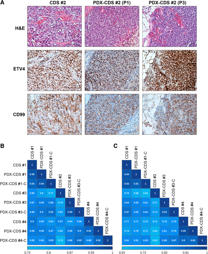 Figure 2. CDS PDX models recapitulated the phenotypic characteristics and transcriptional profiles of the primary tumor. A, Histologic and IHC features of CDS patient samples and corresponding PDXs at different in vivo passages (P1, first passage; P3, third passage). Sections were stained with hematoxylin-eosin (H&E) or with antibodies against the antigens ETV4 and CD99. Bar, 100 μm. B and C, Spearman correlation analysis among the gene expression profiles of CDS tumors, their corresponding PDX models (P3), and the PDX-derived cell lines are shown based on the signatures of 3,179 (B) and 71 (C) DEGs. Correlation coefficients are shown.