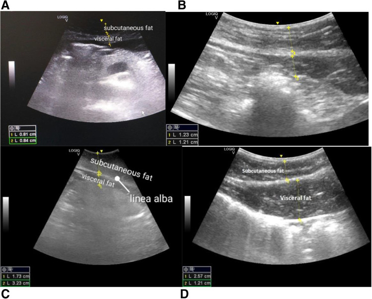 Fig. 4