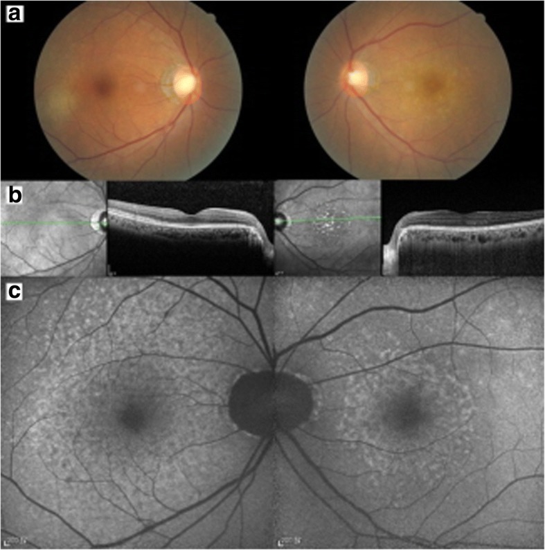 Fig. 1