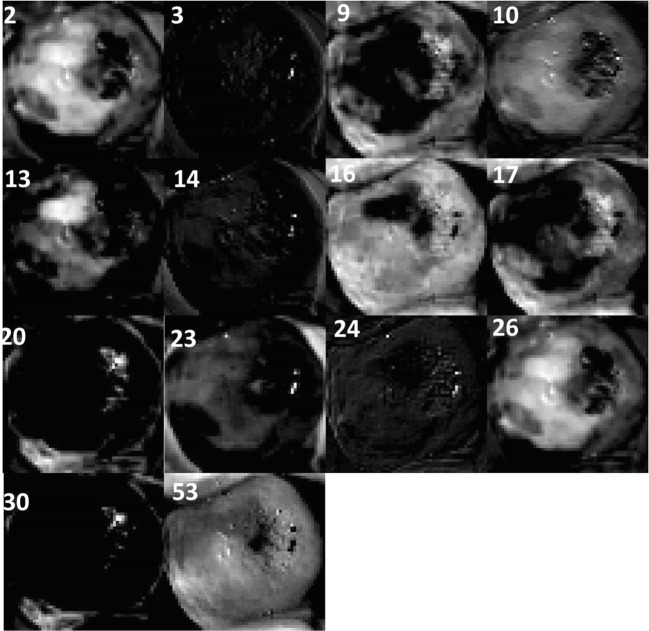Fig. 15