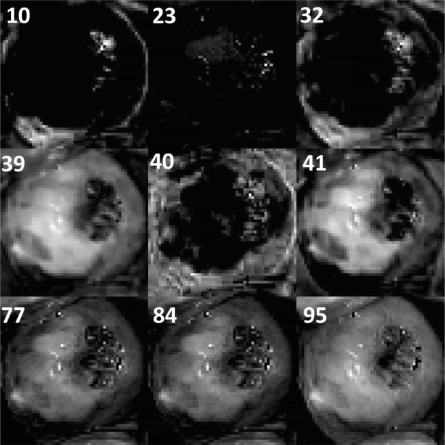 Fig. 13