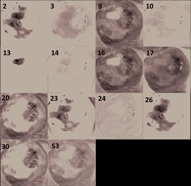 Fig. 14