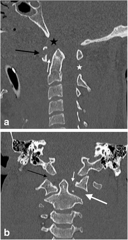 Fig. 17