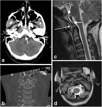 Fig. 12