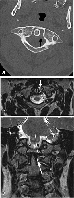 Fig. 21