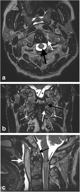 Fig. 18