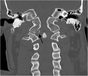 Fig. 13