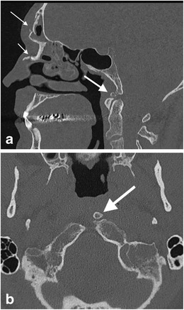 Fig. 5