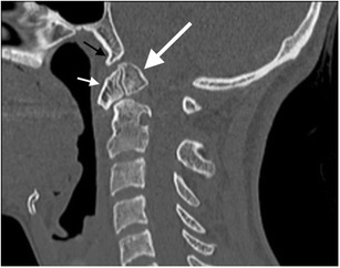 Fig. 10