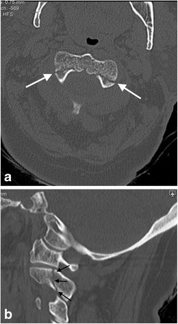 Fig. 20