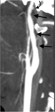 Fig. 23