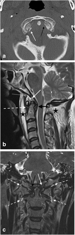 Fig. 22