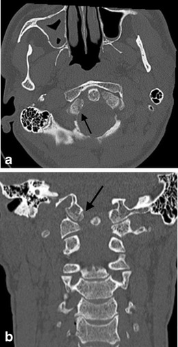 Fig. 15