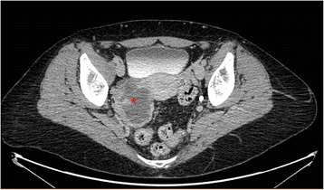 Fig. 2