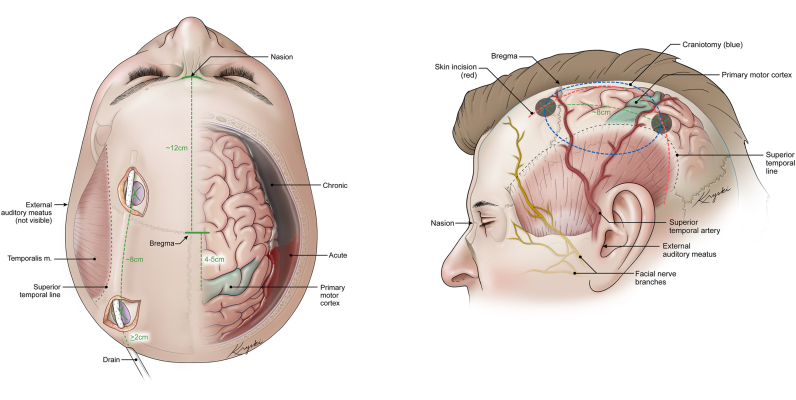 Fig. 1