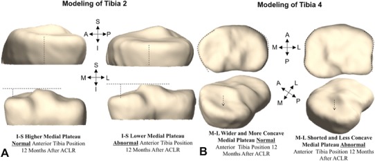 Fig. 4A–B