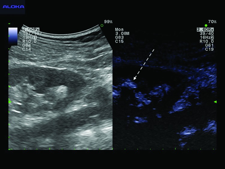 FIG. 2.